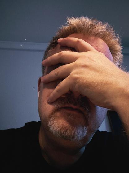 Facepalming man